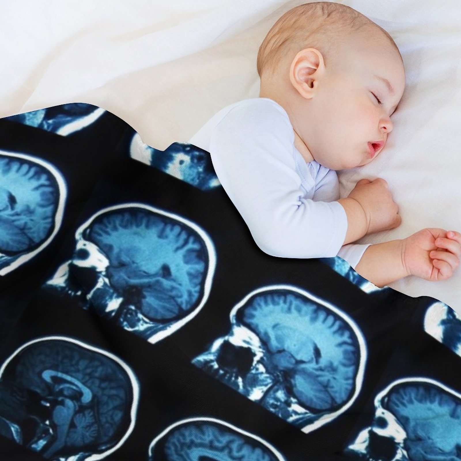 Brain MRI x-ray Throw Blanket  - огляд і ціна 3D Printing X Ray
